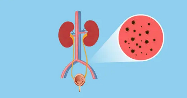 體內(nèi)有結(jié)石，飲食要注意！